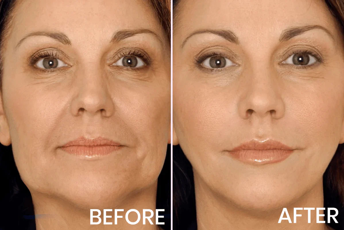 Kitflix® Advanced Firming & Wrinkle-Reducing Cream Buy 1 get 1 free