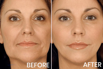 Kitflix® Advanced Firming & Wrinkle-Reducing Cream Buy 1 get 1 free
