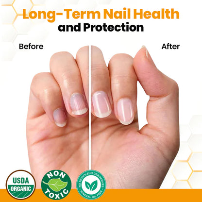 Antifungal Nail Revitalizing Oil with Bee Venom
