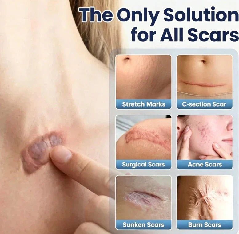 Scar Repair Cream Pack of 2