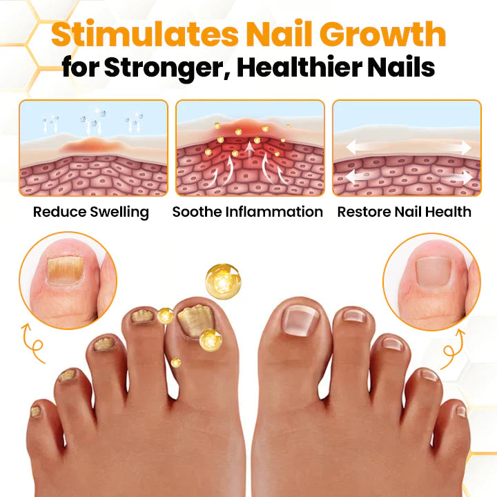 Antifungal Nail Revitalizing Oil with Bee Venom
