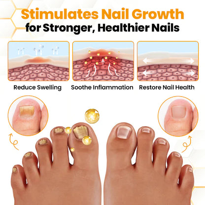 Antifungal Nail Revitalizing Oil with Bee Venom