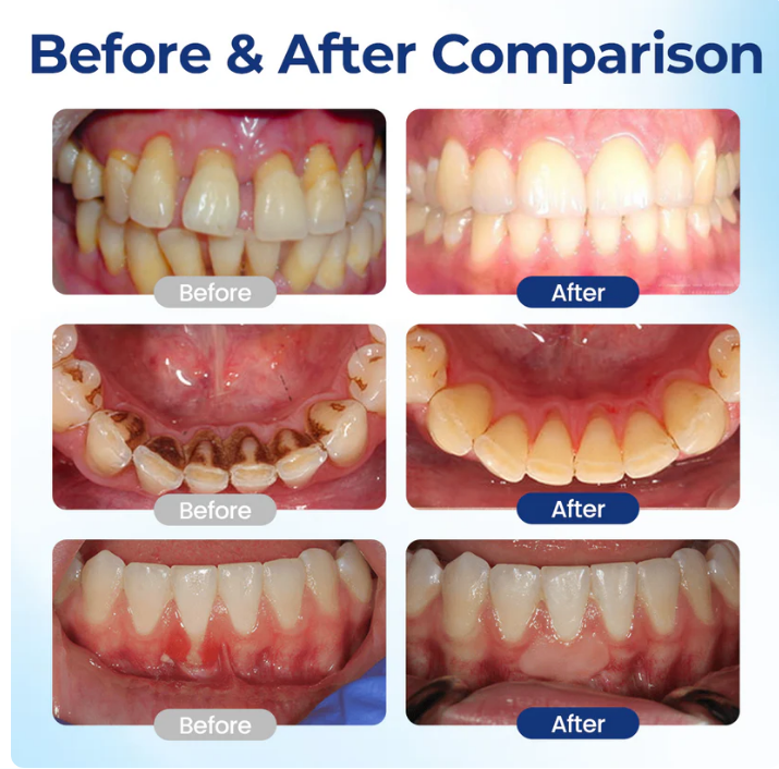 Oral Repair Solution( Buy 1 Get 1 Free)