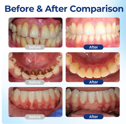 Oral Repair Solution( Buy 1 Get 1 Free)