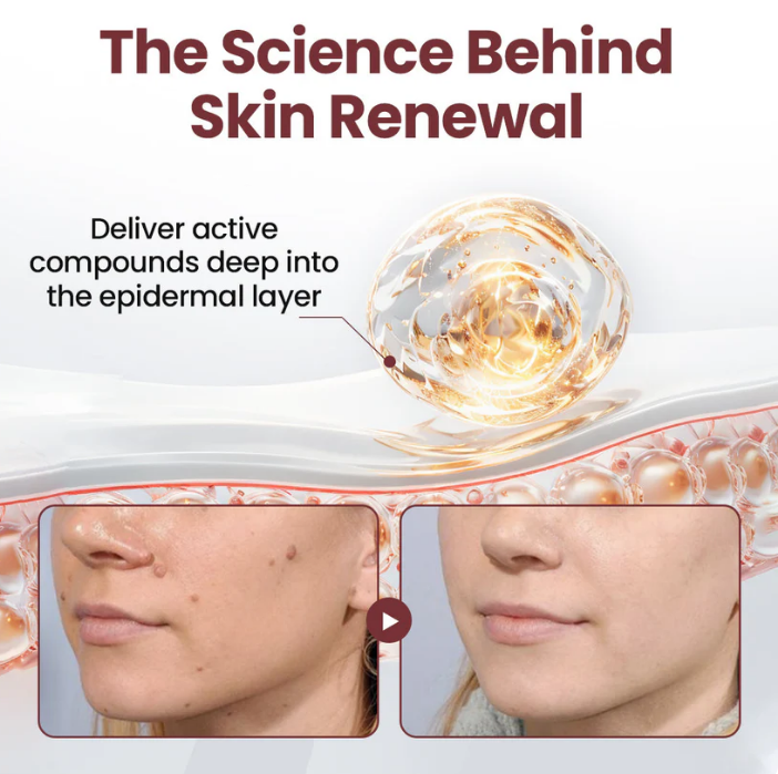 KeraErase® Dual-Action Renewal Cream( Buy 1 Get 2 Free)
