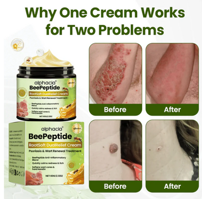 ✅Kitflix® BeePeptide RootSoft DualRelief Cream⚕️ ( Buy 1 Get 1 Free)