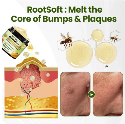 ✅Kitflix® BeePeptide RootSoft DualRelief Cream⚕️ ( Buy 1 Get 1 Free)