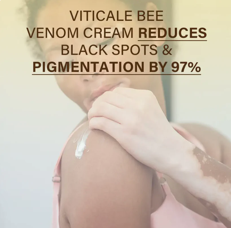VitiClear Bee Venom Cream (BUY 1 GET 1 FREE)