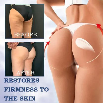 Kitflix® Advanced Firming & Wrinkle-Reducing Cream Buy 1 get 1 free